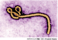 特集2特別寄稿　エボラ出血熱猛威の真相