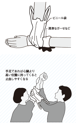 キズの応急処置 病院行く前 行った後 従業員の命を守る 職場の医学 リスク対策 Com 新建新聞社