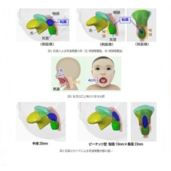 玩具飲み込みによる窒息事故を解析